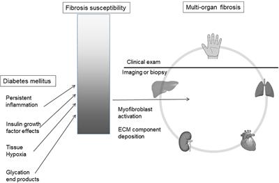 Does hand stiffness reflect internal organ fibrosis in diabetes mellitus?